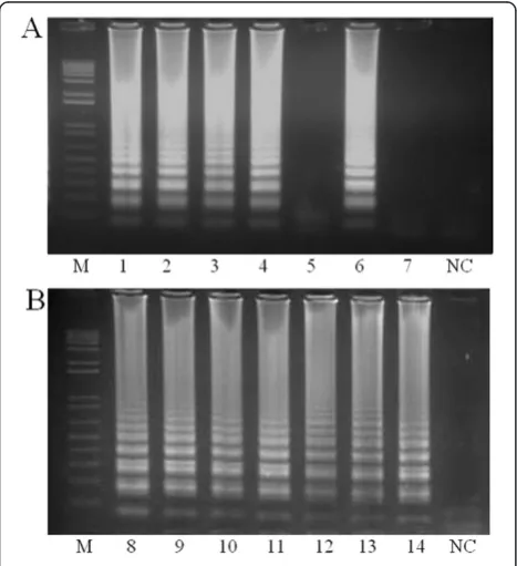 Figure 3 Detection of(A)visualization. (A)Naphtol Blue to the LAMP reaction it was possible to determinewhether a mosquito specimen wasor -uninfected (purple) using the naked eye