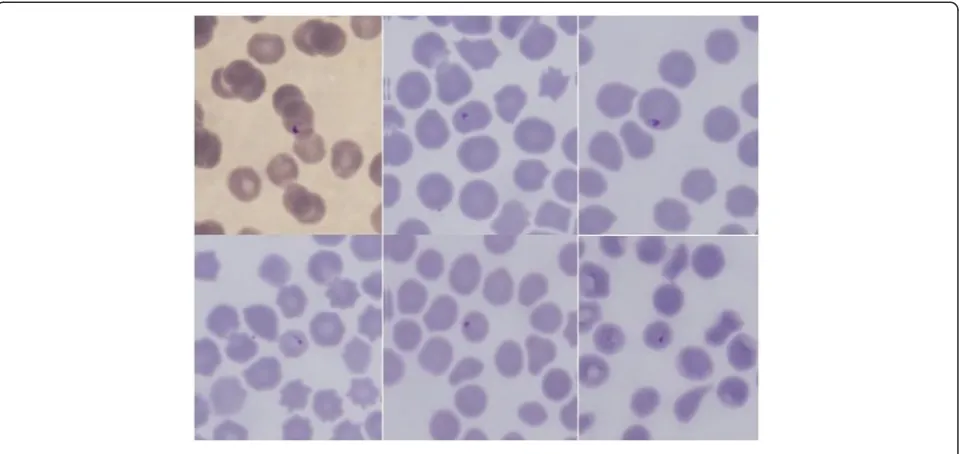 Figure 1 Piroplasms in blood smears from Cervidae.