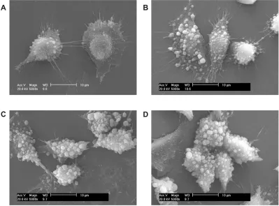 Figure 2 scanning electron microscope images (scale bar = 10 µm) after the adhesion of calcium oxalate dihydrate with African green monkey kidney epithelial cells in the control group at (A) 2 hours, (B) 6 hours, (C) 12 hours, and (D) 24 hours.