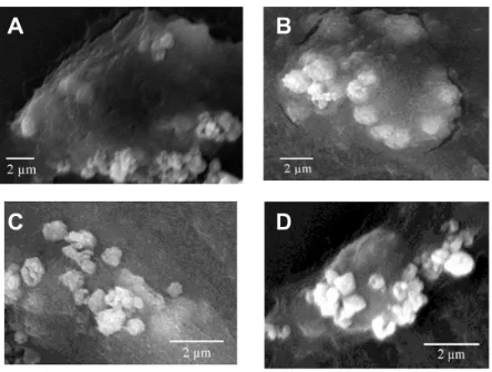 Figure 7 scanning electron microscope images (scale bar = 2 µm) of the calcium oxalate dihydrate crystals endocytosed by African green monkey kidney epithelial cells in the (A and B) control group and (C and D) injury group after adhesion at (A and C) 6 hours and (B and D) 24 hours.