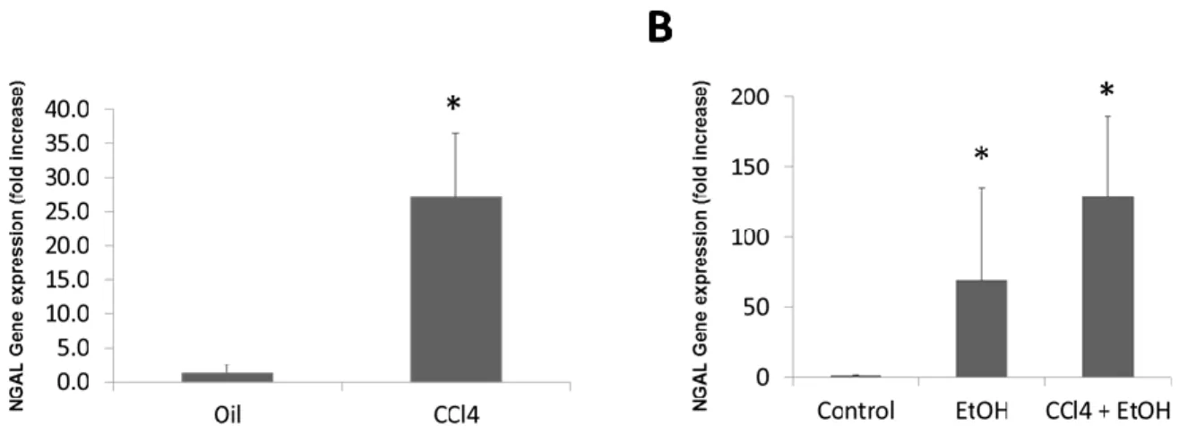 Figure 2. NGAL gene expression in animal models of fibrosis. (A) Hepatic NGAL expression in  mice treated with CCL4 (*p<0.05 compared to oil control)