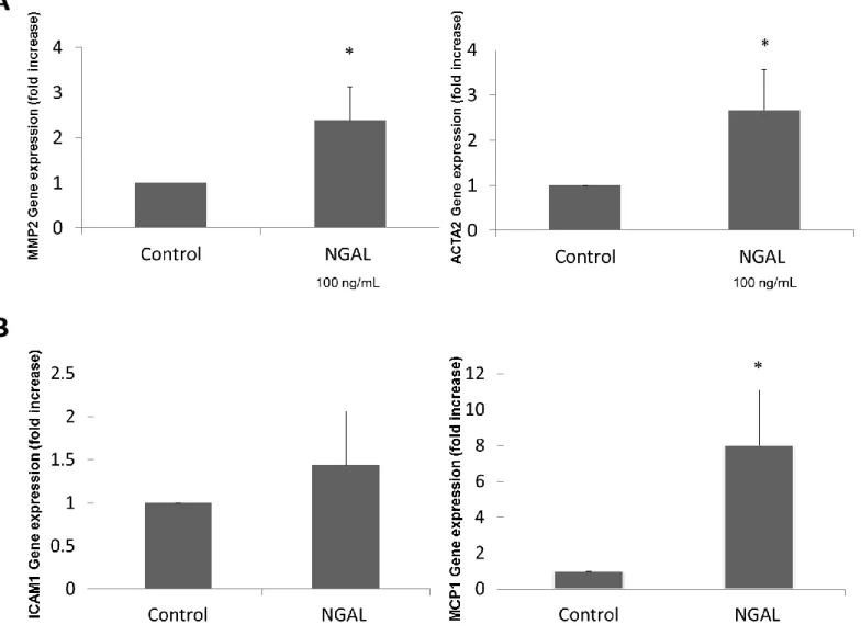 Figure 5. Gene expression of fibrosis and inflammation markers in LX-2 cells. (A) Expression  of MMP2 and ACTA2 (respectively) in LX-2 cells treated with NGAL (*p<0.05 compared to  controls)