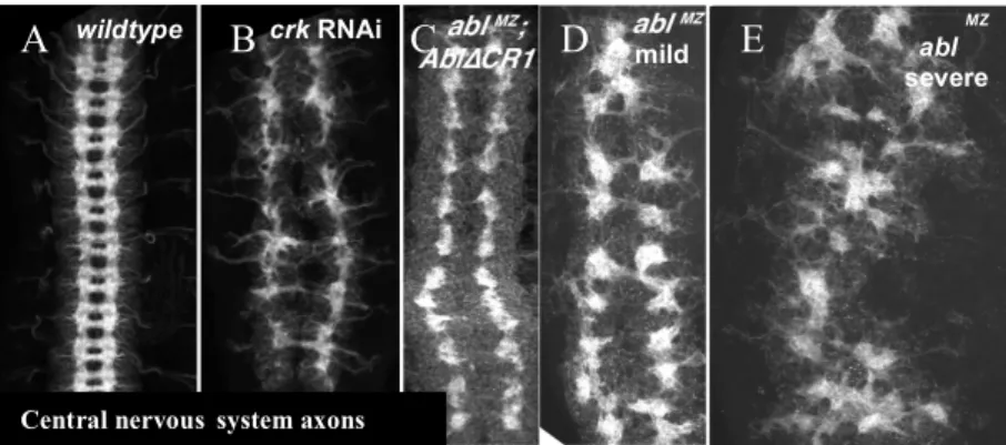 Figure 6. crk RNAi results in CNS patterning defects similar to the minor class of  mild phenotypes seen in of abl maternal/zygotic mutants or upon deletion of CR1