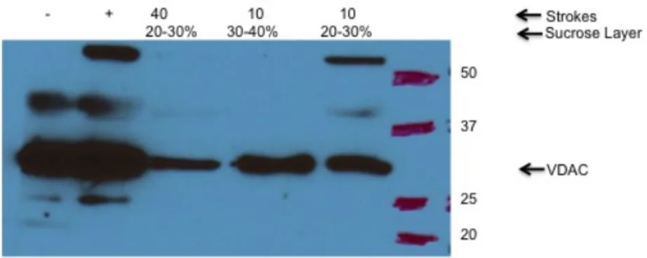 Figure 9. Effect of number of strokes used to homogenize heart on ER contamination. The  positive control (as indicated by + in the western blot) was obtained from a previously purified  mitochondria heart sample