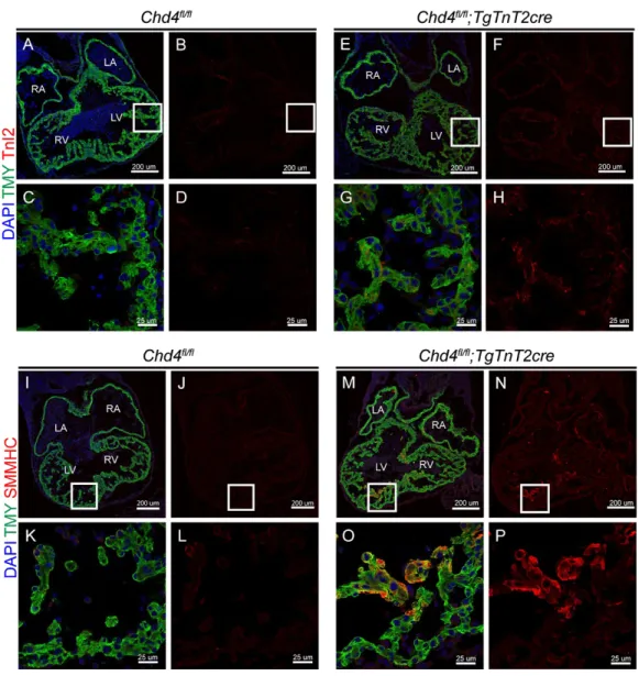 Figure 1. CHD4 is required to repress the expression of fast skeletal Troponin I2  (fsTnI2) and smooth muscle myosin heavy chain (SMMHC) in the myocardium of the  developing heart at (E)10.5