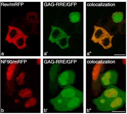 Figure 6NF90ctv affects structured-RNA translocationNF90ctv affects structured-RNA translocation