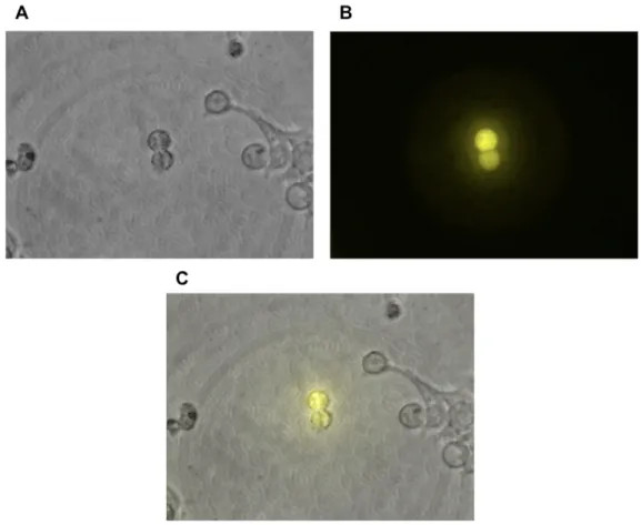 Figure 1. Fluorescent p27-Ven in HEK 293T cells.  A) A DIC image was taken of HEK 293T  mammalian cells that had been transfected with pEXPJC13-p27-Ven