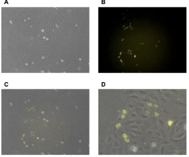 Figure 2. Fluorescent p27-Ven in U2OS cells.  A) DIC image of U2OS mammalian cells  containing pEXPJC17-p27-Ven after adding 10 µg/mL doxycycline