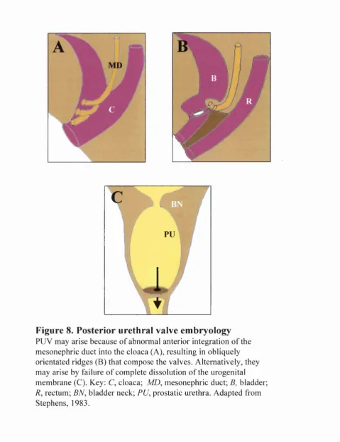 Figure 8. Posterior urethral valve embryology
