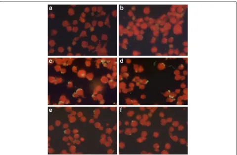 Fig. 2 Photographs of ultraviolet light microscopy (×400) of A. phagocytophilum IgG using IFA and showing a negative control (a), a positive control(b) and for positive dilutions i.e