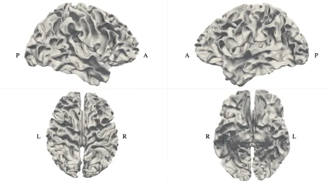 Figure 3: Resampled and registered white matter surface mesh of subject 1 from different view angles