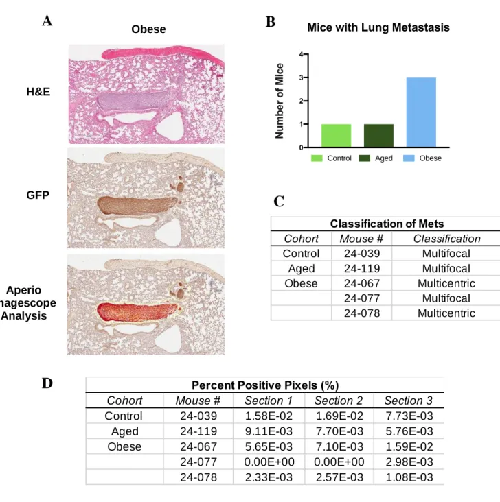 Figure 4. Metastasis Analysis. (A) H&amp;E, GFP, and Aperio Imagescope Analysis of breast cancer metastasis  in extracted lung tissues