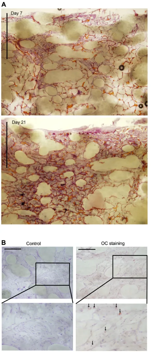 Figure 6 Principle of the composite scaffold with drug eluting matrix embedding. (A) Following tumor resection, remnant tumor cells (orange) may be present and there is an increased risk of recurrence