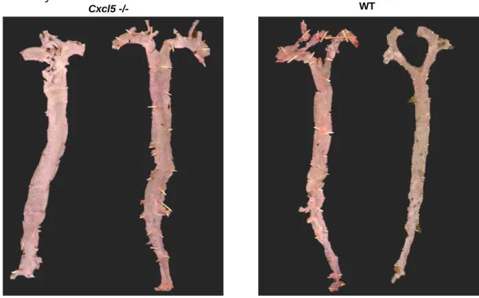 Figure 3. WT and Cxcl5 -/-  mice aortas post en face processing. WT and Cxcl5 -/-  mouse  aortas were isolated post Western diet, fixed, and stained to determine atherosclerotic  lesion formation