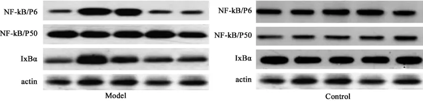 Figure 2. NF-κB/P65, NF-κB/P50, and IκBα expression. 