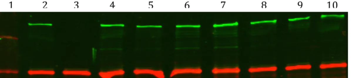 Figure 8. Mutation of multiple ChpA domains may modulate ChpA protein  expression. Lane one is Precision Plus Protein Kaleidoscope ladder with 250kDA top  band
