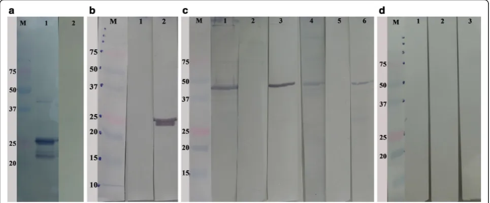 Fig. 4 Expression of rCSUI_005805. Lane M: molecular weight marker.ture (Lane 1); induced culture with 1 mM IPTG for 0.5 h (Lane 2) and 1 h (Lane 3), a Analysis of expressed recombinant protein by SDS-PAGE: uninduced cul- arrows indicate target protein ban
