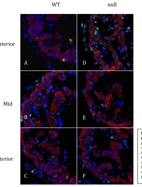Figure 6. PHH3 is expressed in E10.5 wild  type and Casz1 null hearts.  Transverse  paraffin sections of E10.5 embryos stained  with PHH3 antibody (green), TMY antibody  (red) and DAPI (blue)