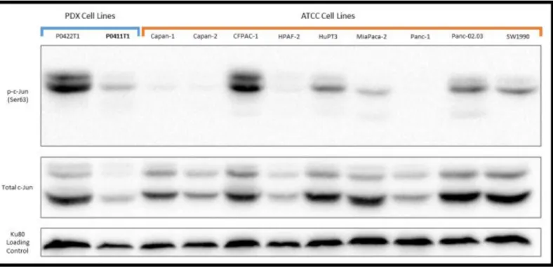 Figure 3. Cell line panel examined for c-Jun expression levels. Both PDX and ATCC cell lines were probed  for their baseline p-c-Jun and total c-Jun expression levels