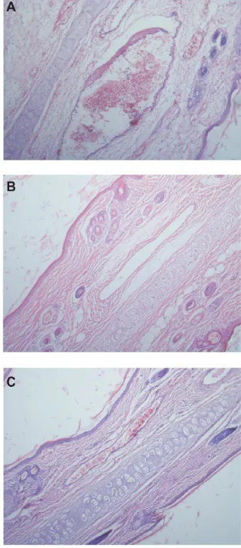 Table 3 The main pharmacokinetic parameters of the NIM injection and NIM-EPC-SGC-MMs in rats