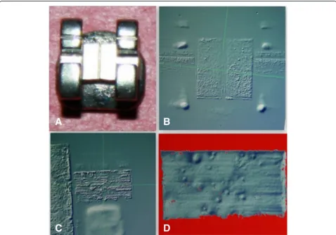Fig. 4 a Stainless steel bracket, b bracket view under the three-dimensional profiler machine, c distal slot view of the bracket, and d distal slotview of the bracket after scanning showing the scanned slot surface