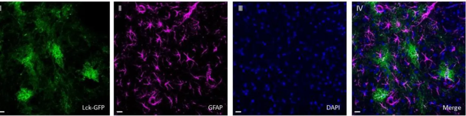 Figure 3. 20X multiple intensity projection image collected within the NAc, showing expression  of (I) Lck-GFP, (II) GFAP, (III) DAPI, and (IV) overlap of the channels