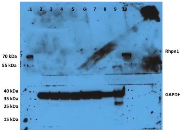 Figure 6. Western blot of Trial 2.  Processed on film (1 min exposure).  Each well  represents: 1) Protein ladder 2) Highper 3) Highper 4) Rhpn1 KO 5) Rhpn1 KO 6) B6J  WT 7) B6J WT 8) B6J WT Kidney #1 9) B6J WT Kidney #2 10) Protein ladder.
