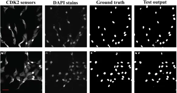 Figure 5.1: Two examples of fluorescent images (DAPI and CDK2 sensor) together with the comparison of ground truth segmentation masks and model output for the same fields of view
