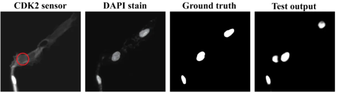 Figure 6.2: Missed DAPI signal causing erroneous missed cell in ground truth.