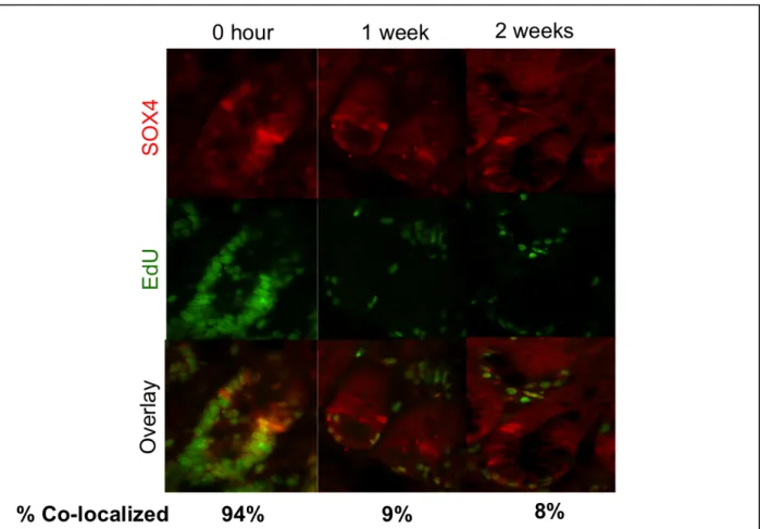Figure 7. SOX4 and EdU colocalization at three timpoints, with quantification n=100 SOX4  expressing cells