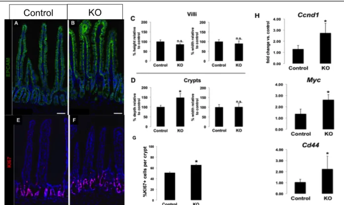Figure 5. A, B, C, D) Confocal imagery of EpCAM with quantification of crypt and villus  dimensions