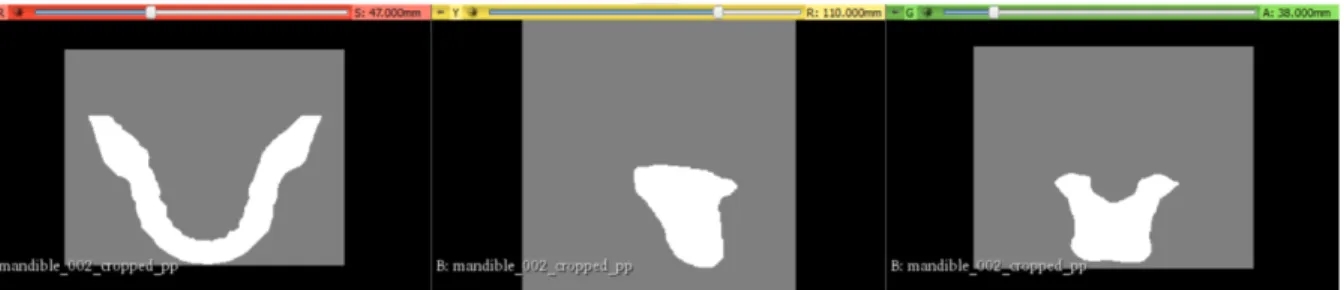 Figure 4: One of the four Mandible volumes visualized in 3D Slicer [11] Volume Module 