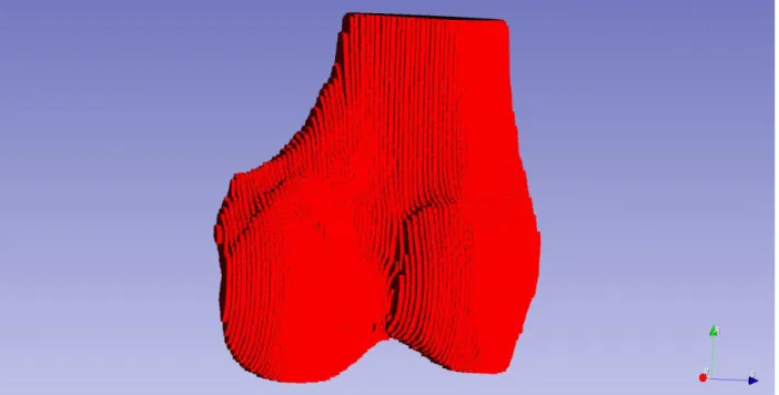 Figure 19: Surface mesh of the femur dataset labeled 002, which is the output of GenParaMesh and will then be mapped onto  parametrized spheres with different iterations