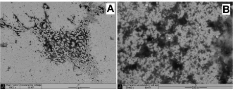 Figure 2 NP2 TEM image (36000× magnification).Abbreviations: NP, nanoparticle; TEM, transmission electron microscopy.