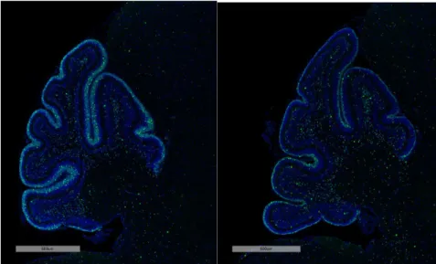Figure 2. Cerebellar tissue from mice treated with vehicle control (left) and with the SHH 