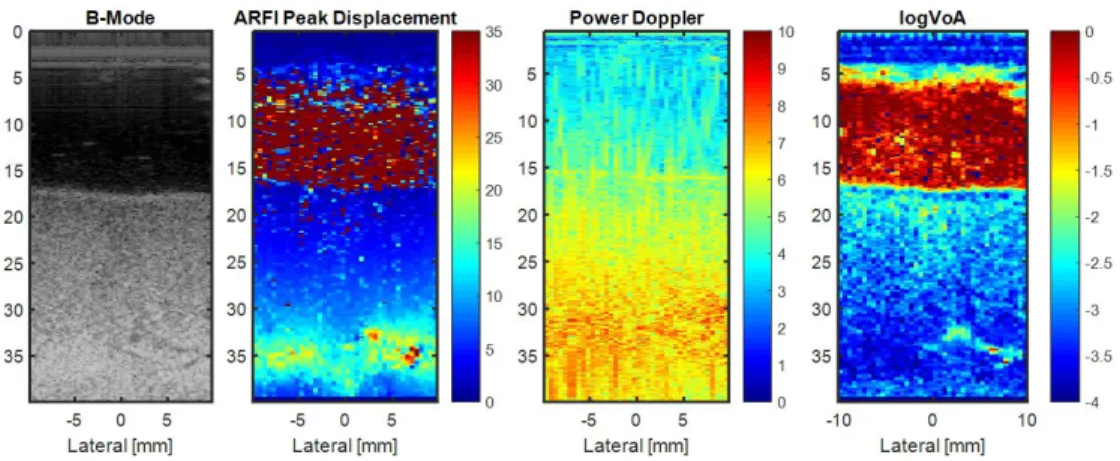 Figure 12.  ​B-mode, ARFI Peak Displacement, Power Doppler, and logVoA images in renal  cortex with artery ligated 