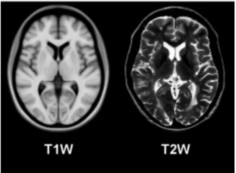 Figure 5. T1w vs. T2w; Nicolas Guizard; May, 2015 