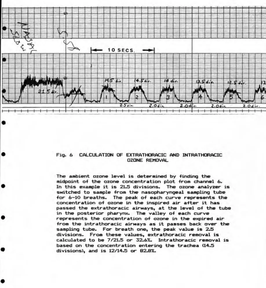Fig.  6     CALCULATION OF EXTRATHORACIC AND  INTRATHCfftACIC
