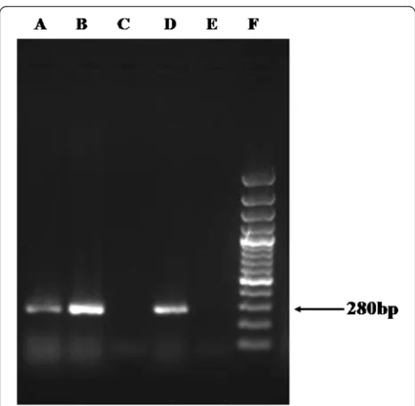 Fig. 3 Representative photograph of 1.5 % agarose gel showing theamplified product of ~280 bp region (DF3) of the 18S rRNA gene ofAcanthamoeba spp