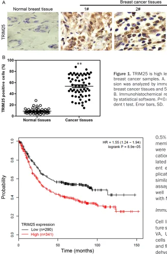Figure 1. TRIM25 is high level expressed in human breast cancer samples. A. TRIM25 protein expres-sion was analyzed by immunohistochemistry in 62 breast cancer tissues and 50 normal breast tissues