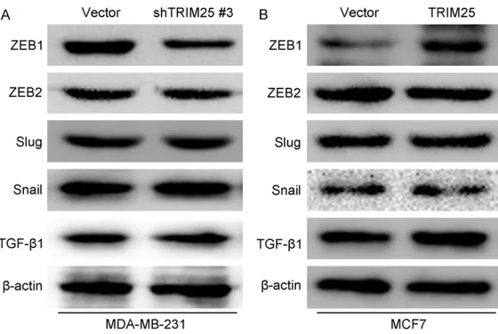 Figure 8. Over-expression of TRIM25 promotes epithelial-mesenchymal fluorescence method was used to detect the expression of E-cadherin and transitions (EMT) in vitro
