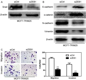 Figure 10. TRIM25 regulates breast cancer cells’ function through modifying ZEB-1. A. Snail protein expression was down regulated in MCF-7-TRIM25 cell line after interfering ZEB-1 through western blot assay