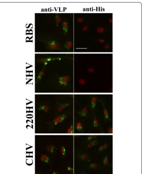 Figure 4 HV maintained the cell entry ability. The purified RBS and three types of HV were used to perform cell invasion assays