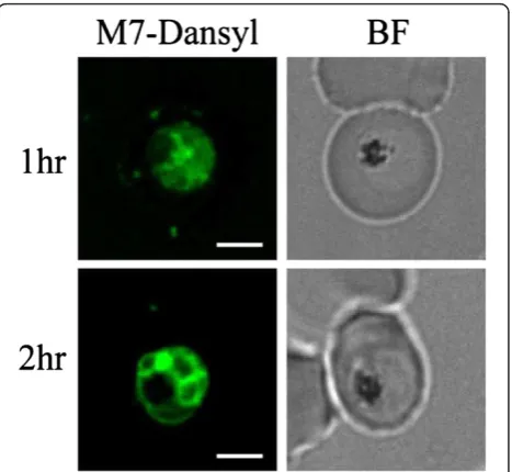 Figure 1 The effect of cholera toxin (CT), MAS 7, or MAS 17 on commitment to gametocytogenesis was determined using thetransgenic Plasmodium falciparum line 3D716-GFP