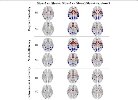 Fig. 1 The effect of oscillation frequencies on network properties. Paired t-tests were performed to identify the effect of oscillation frequencies