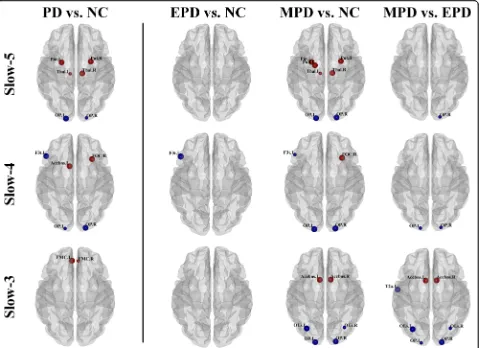 Fig. 2 Oscillation-specific alterations of nodal degree centrality in parkinsonian status