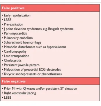 Table 5. Common ECG Pitfalls in Diagnosing Myocardial Infarction