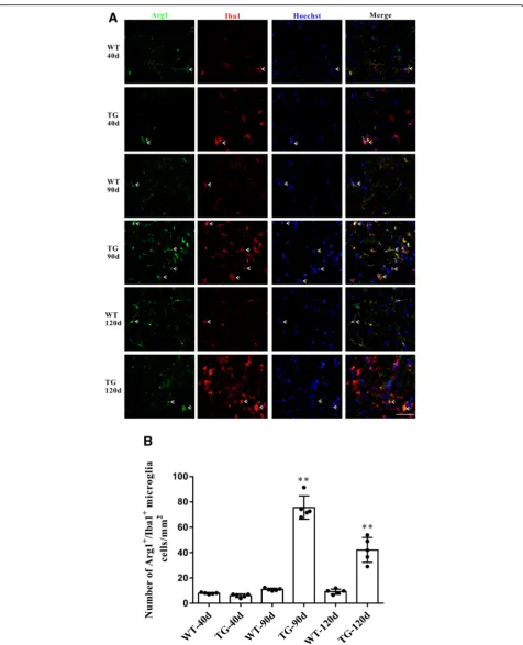 Fig. 6 The changes of M2 microglial phenotypes in TG mice at different time points.Iba1 (red) at different time points, Sale bar = 50 a Double immunofluorescent staining of Arg1 (green) and μm