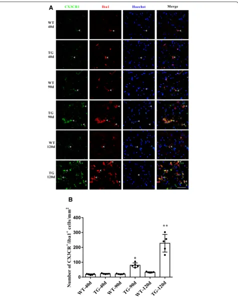 Fig. 3 CX3CR1 was mainly located in microglia and was increased in the TG mice at the age of 90 and 120 days.staining of CX3CR1 (green) and Iba1(red) in the anterior horn of lumber spinal cord of WT and TG mice at the age of 40, 90 and 120 days