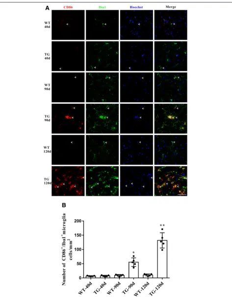 Fig. 5 The changes of M1 microglia in the TG mice at different time points. a Double immunofluorescent staining of CD86 (red) and Iba1 (green)at different time points, Sale bar = 50 μm
